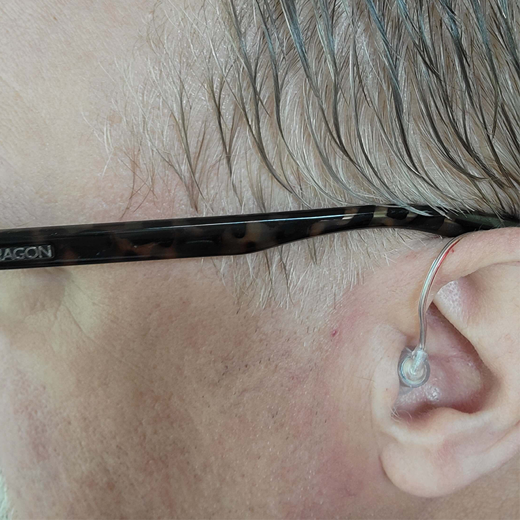 Rechargeable OTC Hearing Aids